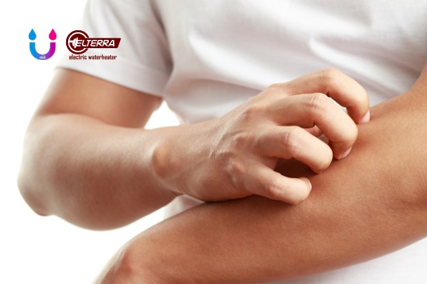 air hangat menghilangkan gatal