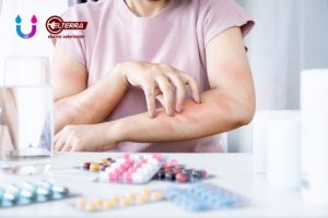 Mandi Air Garam dan Gatal pada Kulit